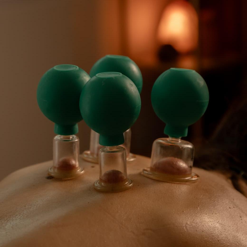 Close‑up van vier cuppingglazen met groene knijpbollen op iemands rug.